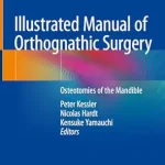 خرید و دانلود نسخه کامل کتاب Illustrated Manual of Orthognathic Surgery: Osteotomies of the Mandible