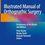 خرید و دانلود نسخه کامل کتاب Illustrated Manual of Orthognathic Surgery: Osteotomies of the Maxilla and Midface