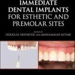 خرید و دانلود نسخه کامل کتاب Immediate Dental Implants for Esthetic and Premolar Sites