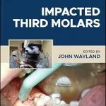 خرید و دانلود نسخه کامل کتاب Impacted Third Molars