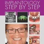 خرید و دانلود نسخه کامل کتاب Implantology Step by Step