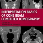 خرید و دانلود نسخه کامل کتاب Interpretation Basics of Cone Beam Computed Tomography