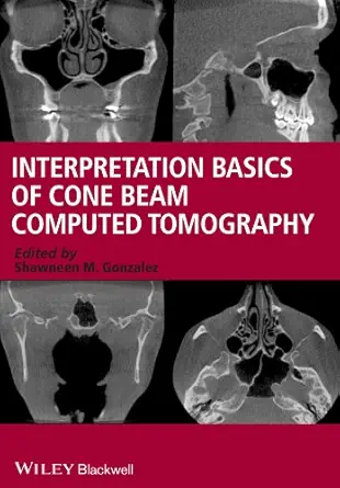 خرید و دانلود نسخه کامل کتاب Interpretation Basics of Cone Beam Computed Tomography_6a62b545dc354.webp خرید و دانلود نسخه کامل کتاب Interpretation Basics of Cone Beam Computed Tomography - تصویر 1