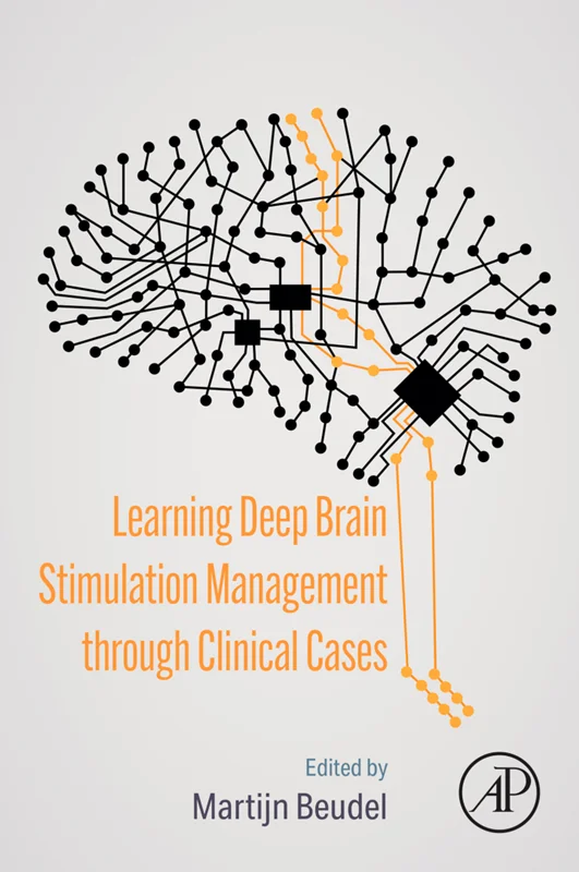 خرید و دانلود نسخه کامل کتاب
Learning Deep Brain Stimulation Management through Clinical Cases_6a5d69ecd98a5.webp خرید و دانلود نسخه کامل کتاب
Learning Deep Brain Stimulation Management through Clinical Cases سورنا بوک - تصویر 1