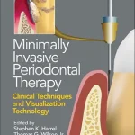خرید و دانلود نسخه کامل کتاب Minimally Invasive Periodontal Therapy: Clinical Techniques and Visualization Technology