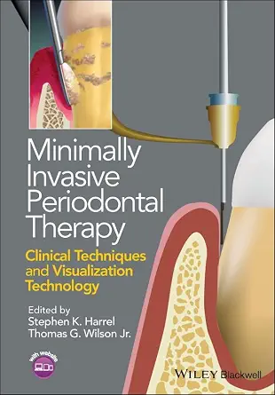 خرید و دانلود نسخه کامل کتاب Minimally Invasive Periodontal Therapy: Clinical Techniques and Visualization Technology_6a62ded344f83.webp خرید و دانلود نسخه کامل کتاب Minimally Invasive Periodontal Therapy: Clinical Techniques and Visualization Technology - تصویر 1