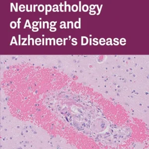 خرید و دانلود نسخه کامل کتاب 
Neuropathology of Aging and Alzheimer's Disease