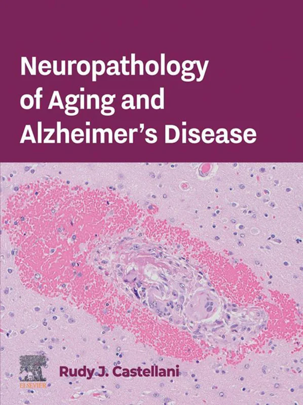 خرید و دانلود نسخه کامل کتاب
Neuropathology of Aging and Alzheimer’s Disease_6a5e35b939312.webp خرید و دانلود نسخه کامل کتاب
Neuropathology of Aging and Alzheimer's Disease - تصویر 1