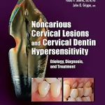خرید و دانلود نسخه کامل کتاب Noncarious Cervical Lesions and Cervical Dentin Hypersensitivity: Etiology, Diagnosis, and Treatment