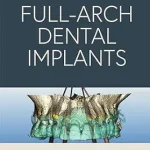 خرید و دانلود نسخه کامل کتاب Northern Virginia Periodontics Guide to Full-Arch Dental Implants