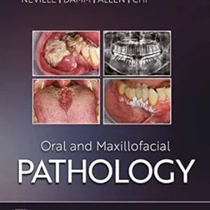 خرید و دانلود نسخه کامل کتاب Oral and Maxillofacial Pathology