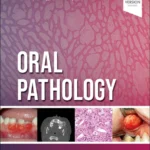 خرید و دانلود نسخه کامل کتاب 
Oral Pathology 3rd Edition سورنا بوک