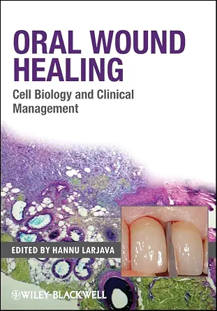 خرید و دانلود نسخه کامل کتاب Oral Wound Healing: Cell Biology and Clinical Management_6a664f9651dfd.webp خرید و دانلود نسخه کامل کتاب Oral Wound Healing: Cell Biology and Clinical Management - تصویر 1
