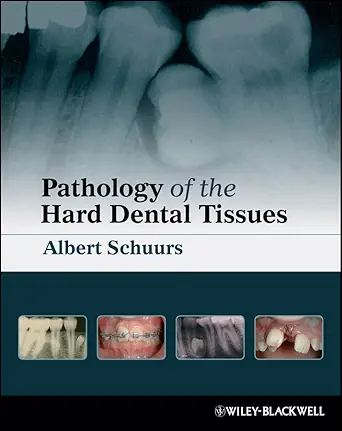 خرید و دانلود نسخه کامل کتاب Pathology of the Hard Dental Tissues_6a62ad1e73eb7.webp خرید و دانلود نسخه کامل کتاب Pathology of the Hard Dental Tissues - تصویر 1