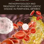 خرید و دانلود نسخه کامل کتاب 
Pathophysiology and Treatment of Atherosclerotic Disease in Peripheral Arteries سورنا بوک
