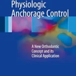 خرید و دانلود نسخه کامل کتاب Physiologic Anchorage Control: A New Orthodontic Concept and its Clinical Application