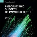 خرید و دانلود نسخه کامل کتاب Piezoelectric surgery of impacted teeth Kindle Edition