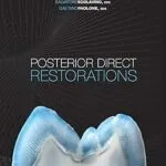 خرید و دانلود نسخه کامل کتاب Posterior Direct Restorations