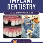 خرید و دانلود نسخه کامل کتاب Practical Procedures in Implant Dentistry