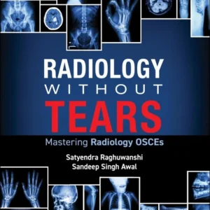 خرید و دانلود نسخه کامل کتاب 
Radiology Without Tears: Mastering Radiology OSCEs