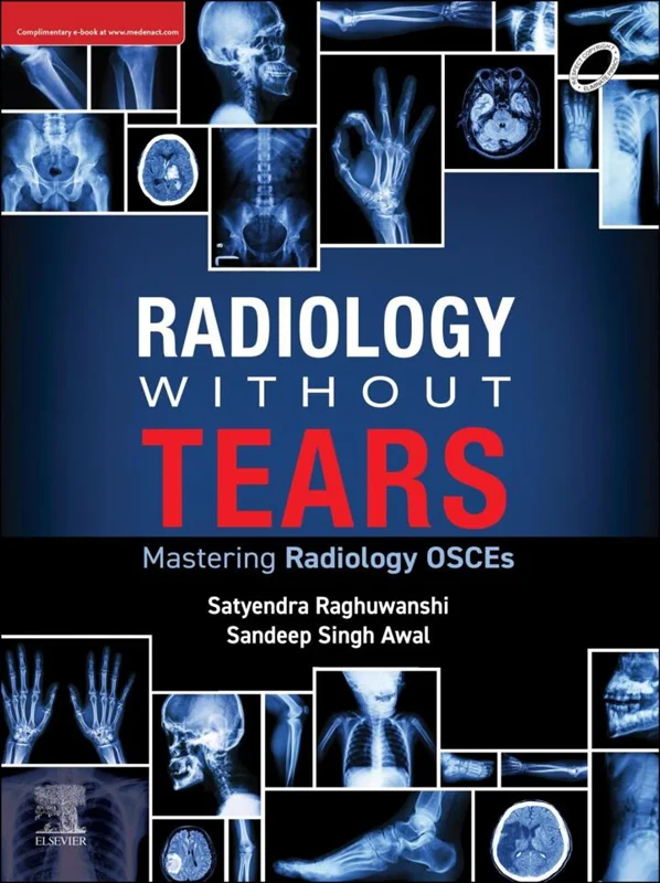 خرید و دانلود نسخه کامل کتاب
Radiology Without Tears: Mastering Radiology OSCEs_6a5eb6f04877b.webp خرید و دانلود نسخه کامل کتاب
Radiology Without Tears: Mastering Radiology OSCEs - تصویر 1