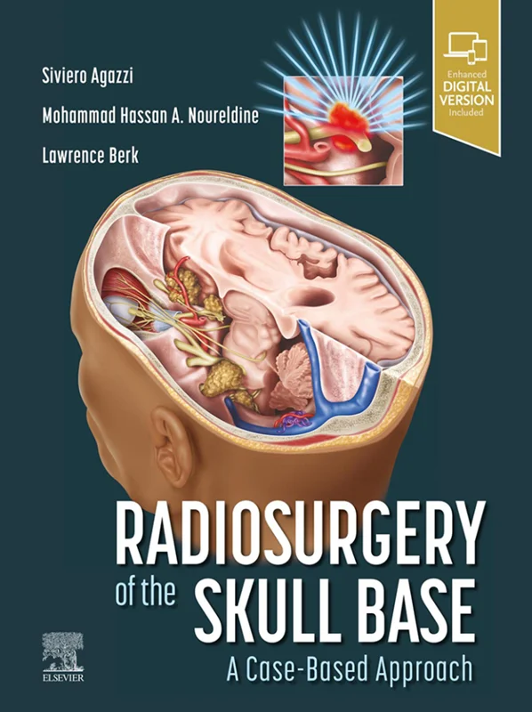 خرید و دانلود نسخه کامل کتاب
Radiosurgery of the Skull Base: A Case-Based Approach_6a5da72650fd8.webp خرید و دانلود نسخه کامل کتاب
Radiosurgery of the Skull Base: A Case-Based Approach سورنا بوک - تصویر 1