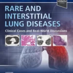 خرید و دانلود نسخه کامل کتاب 
Rare and Interstitial Lung Diseases: Clinical Cases and Real-World Discussions