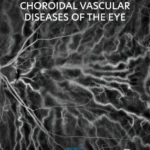 خرید و دانلود نسخه کامل کتاب 
Retinal and Choroidal Vascular Diseases of the Eye سورنا بوک