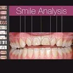 خرید و دانلود نسخه کامل کتاب Smile Analysis