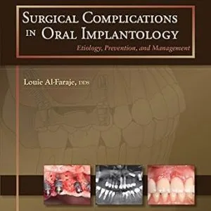 خرید و دانلود نسخه کامل کتاب Surgical Complications in Oral Implantology: Etiology, Prevention, and Management