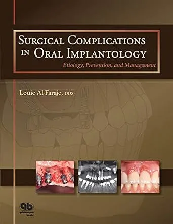 خرید و دانلود نسخه کامل کتاب Surgical Complications in Oral Implantology: Etiology, Prevention, and Management_6a6257f3daf95.jpeg خرید و دانلود نسخه کامل کتاب Surgical Complications in Oral Implantology: Etiology, Prevention, and Management - تصویر 1