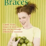 خرید و دانلود نسخه کامل کتاب Surviving Braces