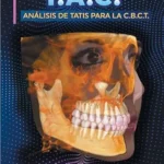 خرید و دانلود نسخه کامل کتاب T.A.C. Análisis de Tatis para la C.B.C.T. Medición Volumétrica Cráneo-Facial (Spanish Edition)