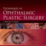 خرید و دانلود نسخه کامل کتاب 
Techniques in Ophthalmic Plastic Surgery: A Personal Tutorial 2nd Edition
