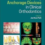 خرید و دانلود نسخه کامل کتاب Temporary Anchorage Devices in Clinical Orthodontics