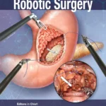خرید و دانلود نسخه کامل کتاب 
The Foundation and Art of Robotic Surgery سورنا بوک