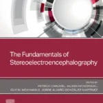 خرید و دانلود نسخه کامل کتاب 
The Fundamentals of Stereoelectroencephalography