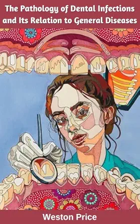 خرید و دانلود نسخه کامل کتاب The Pathology of Dental Infections and Its Relation to General Diseases_6a62a5eb25f94.webp خرید و دانلود نسخه کامل کتاب The Pathology of Dental Infections and Its Relation to General Diseases - تصویر 1