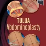 خرید و دانلود نسخه کامل کتاب 
TULUA Abdominoplasty: Transverse Plication Technique