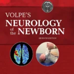 خرید و دانلود نسخه کامل کتاب 
Volpe's Neurology of the Newborn 7th Edition
