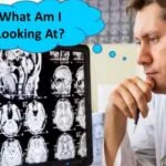 خرید و دانلود نسخه کامل آموزش خواندن ام آر آی MRI مغز